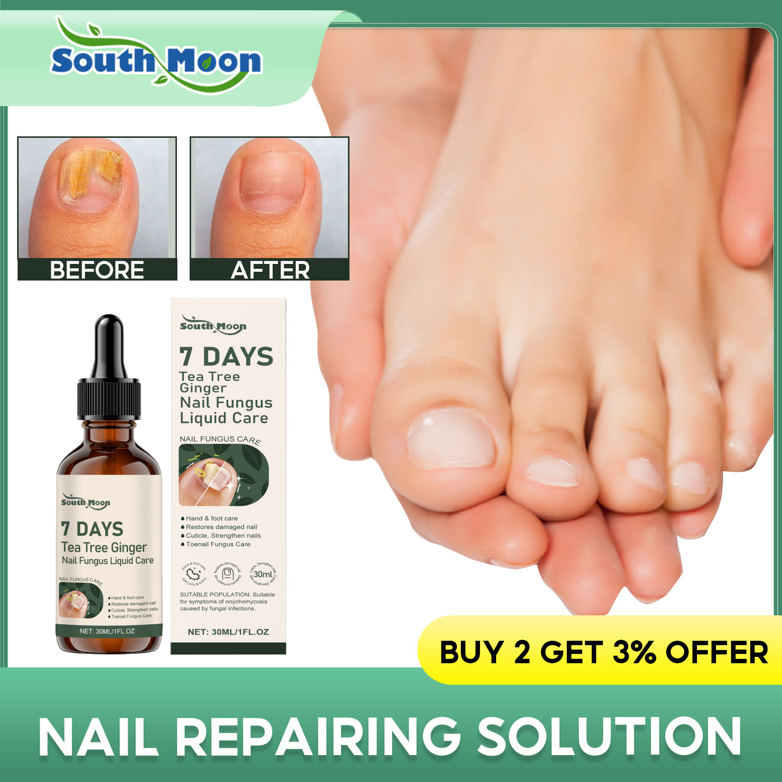 Nail Art Maroon - Nail Fungus Treatment Liquid Repair Damaged